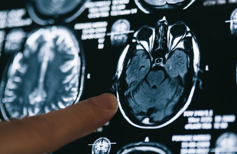Conférence-débat « Imagerie du cerveau humain, quelles avancées pour la médecine ? »